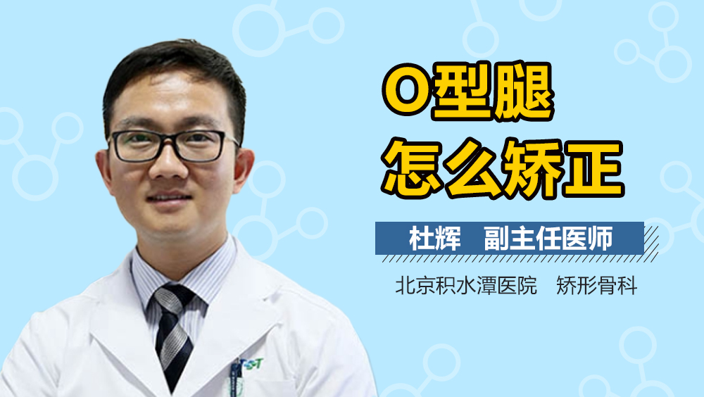 O型腿怎么矫正