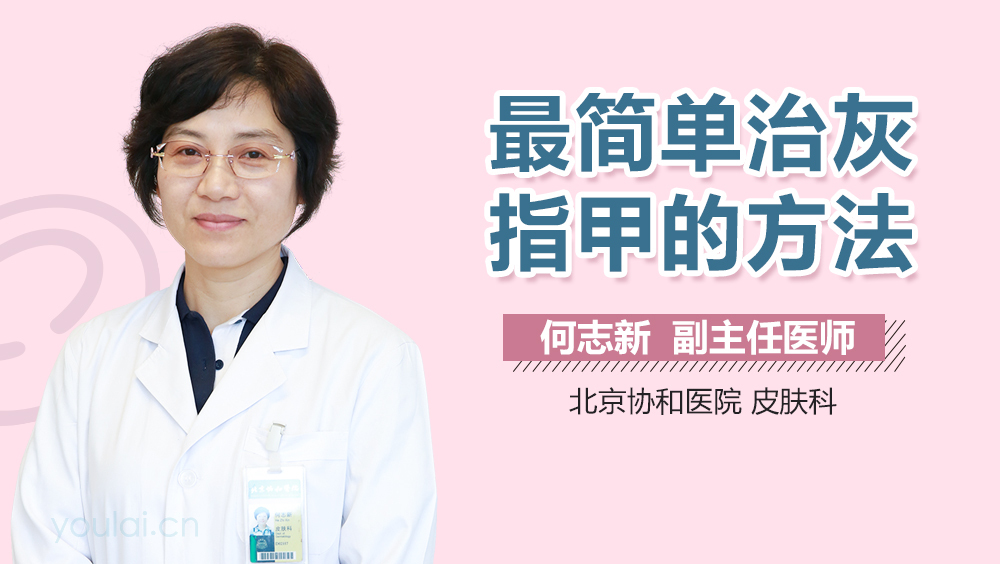最简单治灰指甲的方法