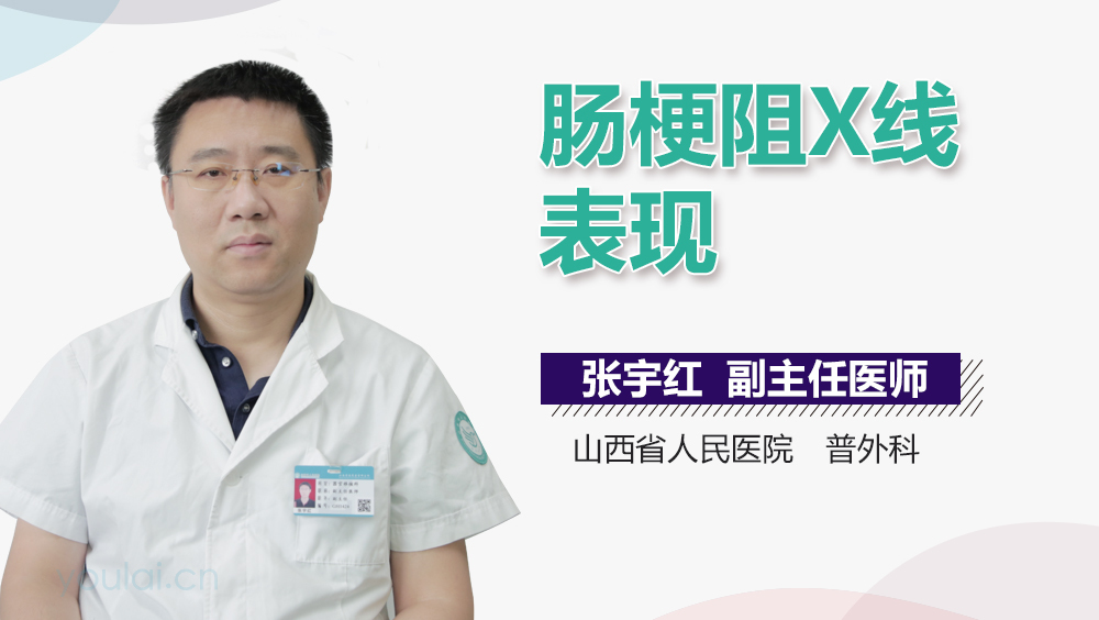 肠梗阻X线表现