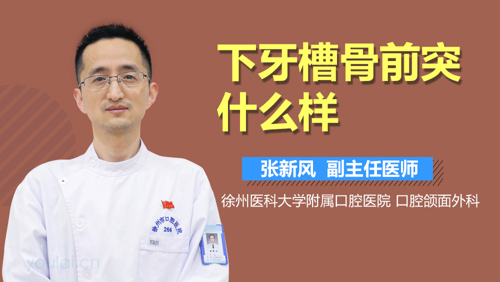下牙槽骨前突什么样