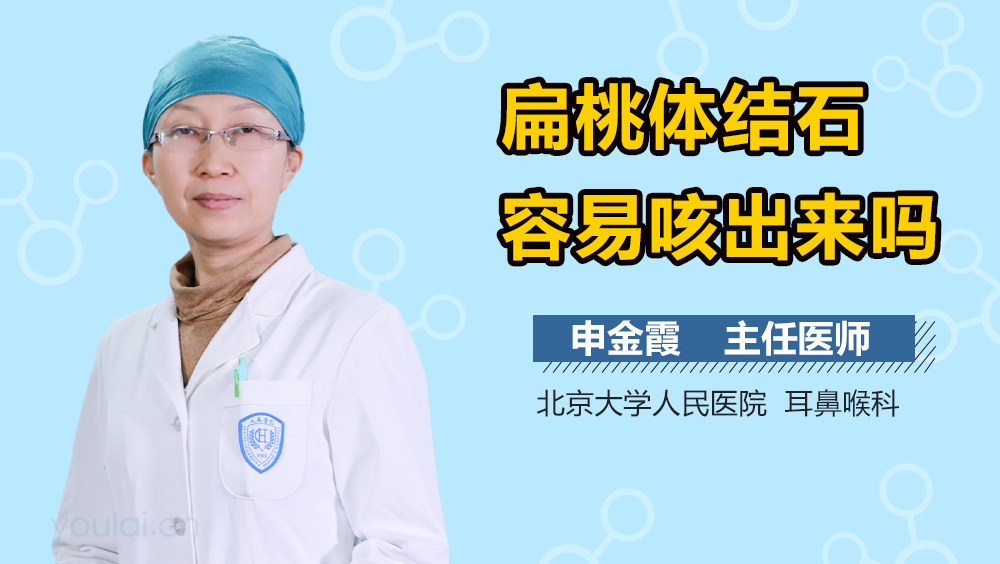 扁桃体结石容易咳出来吗