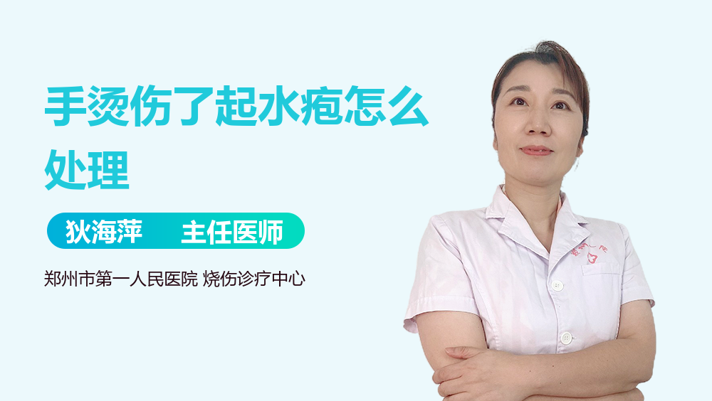 手烫伤了起水疱怎么处理