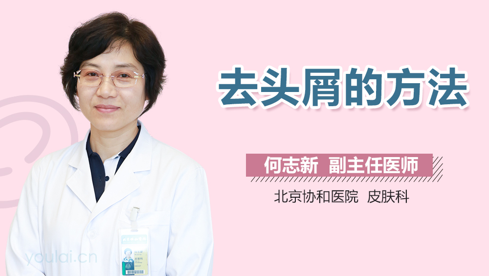 去头屑的方法