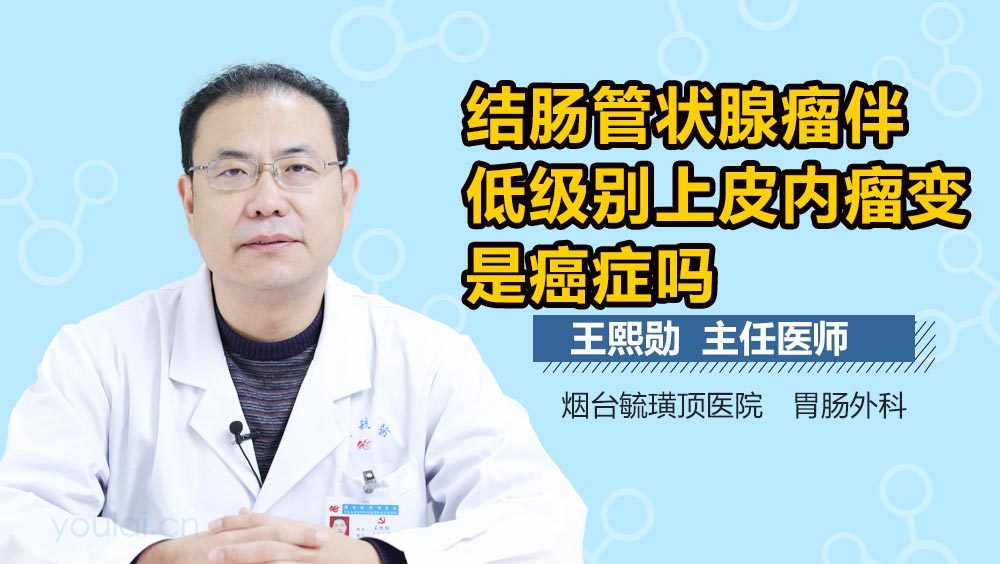 结肠管状腺瘤伴低级别上皮内瘤变是癌症吗