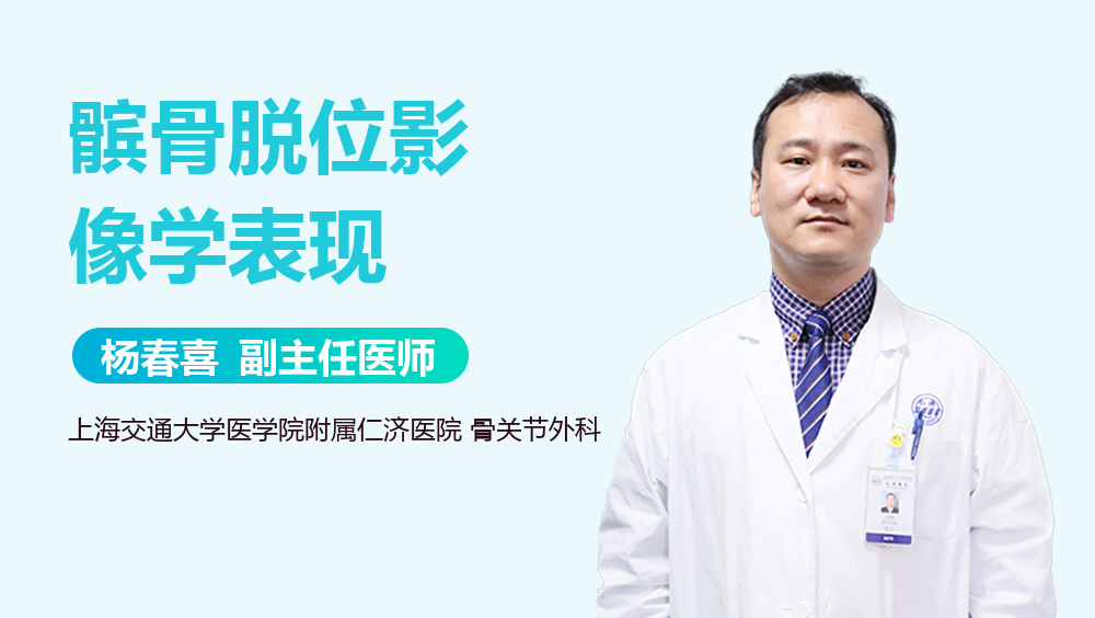 髌骨脱位影像学表现