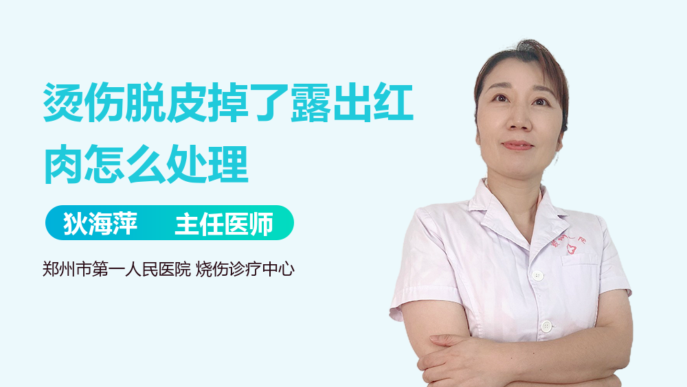 烫伤脱皮掉了露出红肉怎么处理