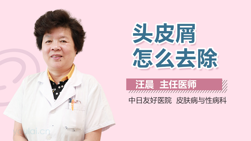 头皮屑怎么去除