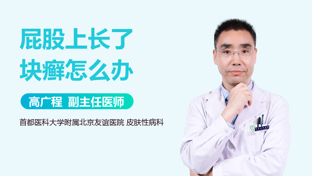 屁股上长了块癣怎么办