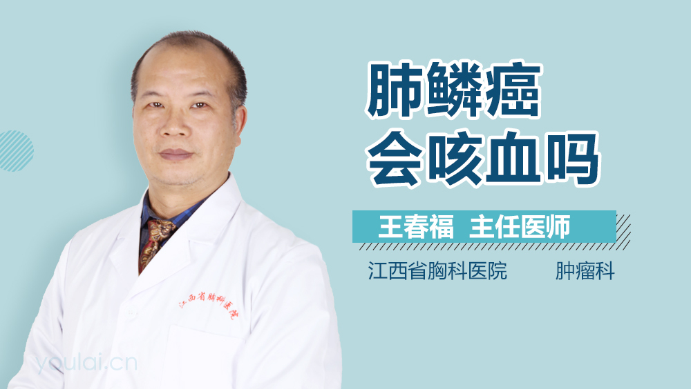 肺鳞癌会咳血吗