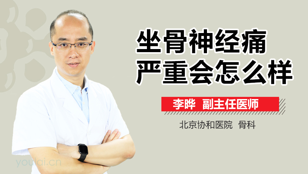 坐骨神经痛严重会怎么样
