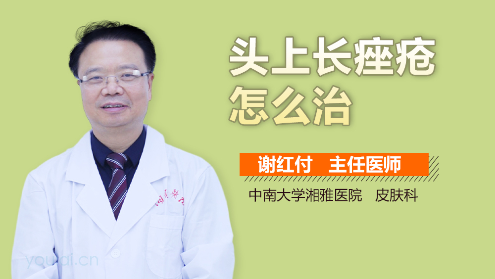 头上长痤疮怎么治