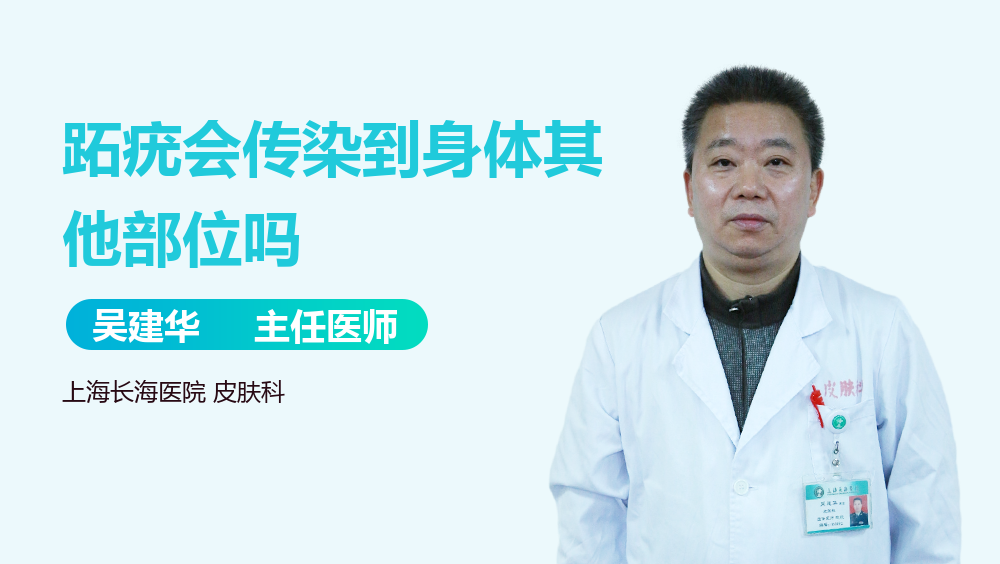 跖疣会传染到身体其他部位吗