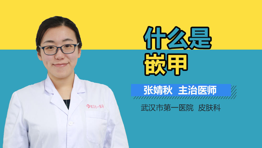 什么是嵌甲