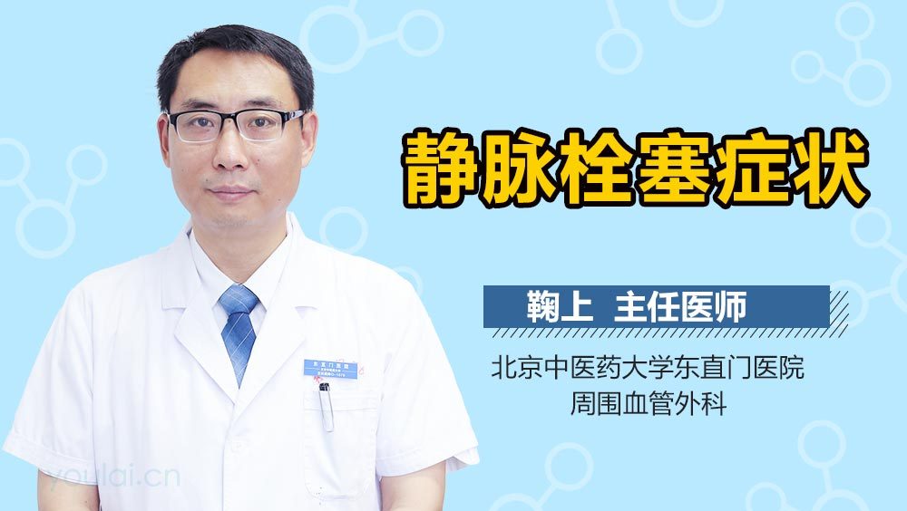 静脉栓塞症状