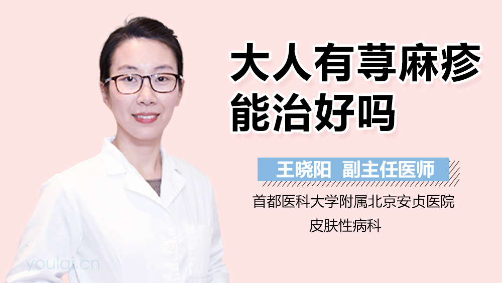 大人有荨麻疹能治好吗