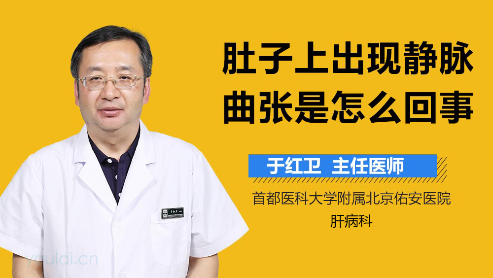 肚子上出现静脉曲张是怎么回事