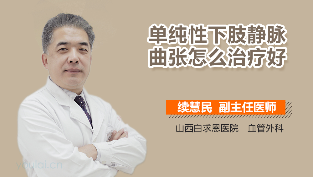 单纯性下肢静脉曲张怎么治疗好