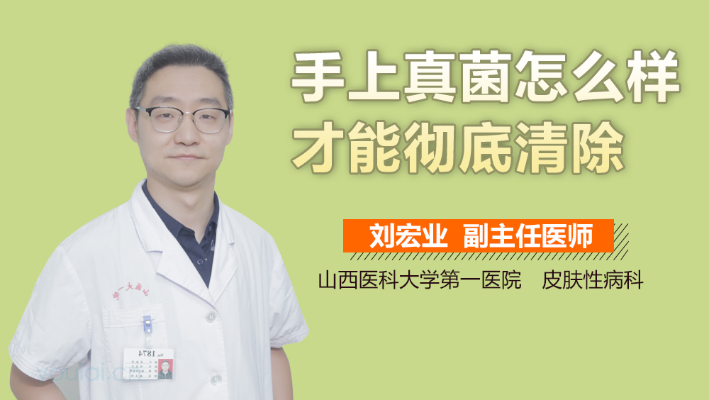 手上真菌怎么样才能彻底清除