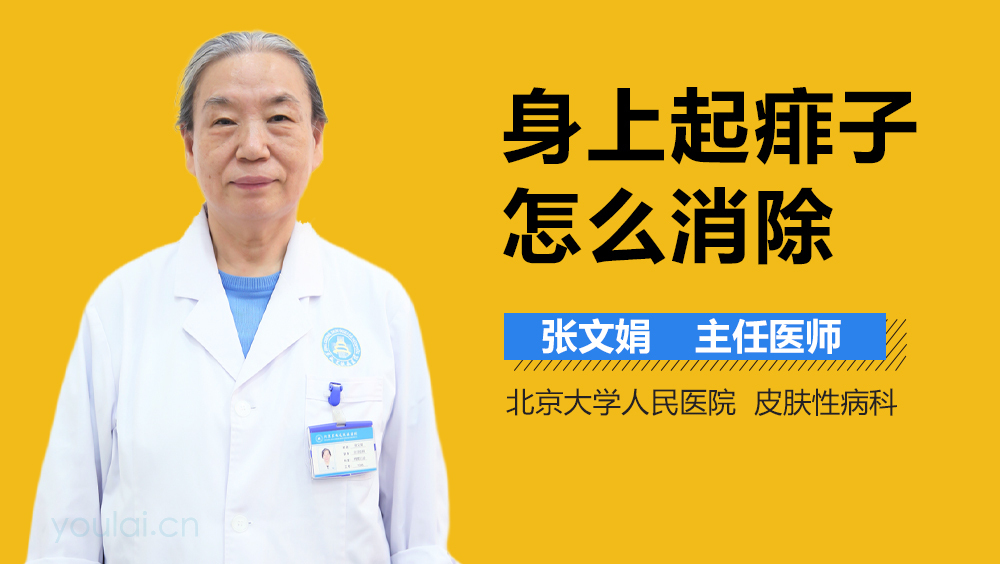 身上起痱子怎么消除