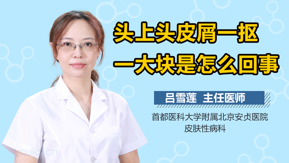 头上头皮屑一抠一大块是怎么回事