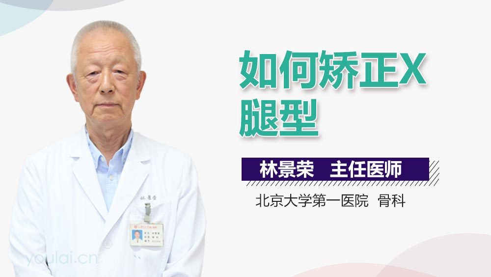 如何矫正X型腿