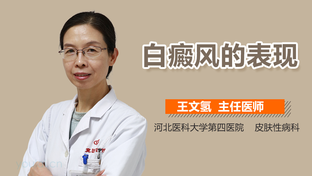 白癜风的表现