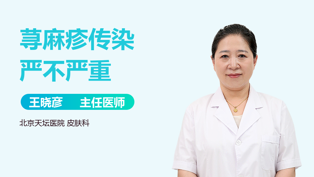 荨麻疹传染严不严重