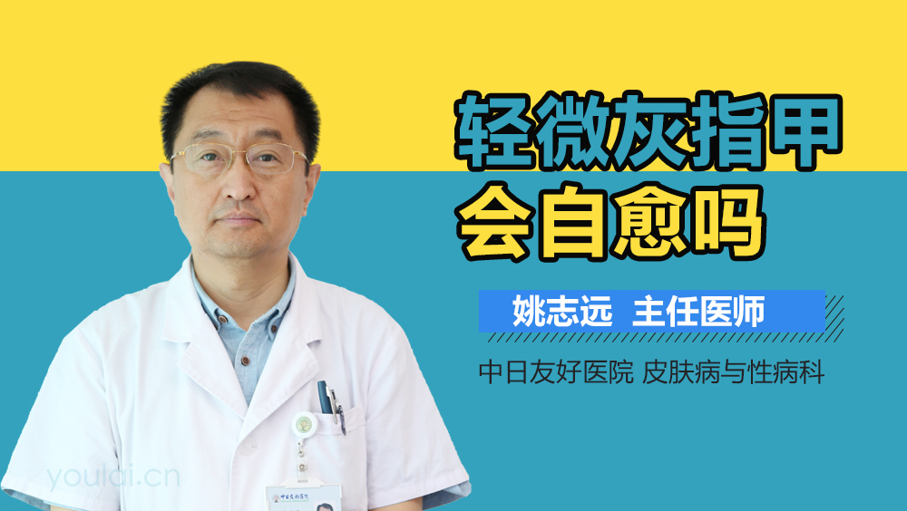 轻微灰指甲会自愈吗