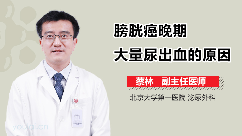 膀胱癌晚期大量尿出血的原因