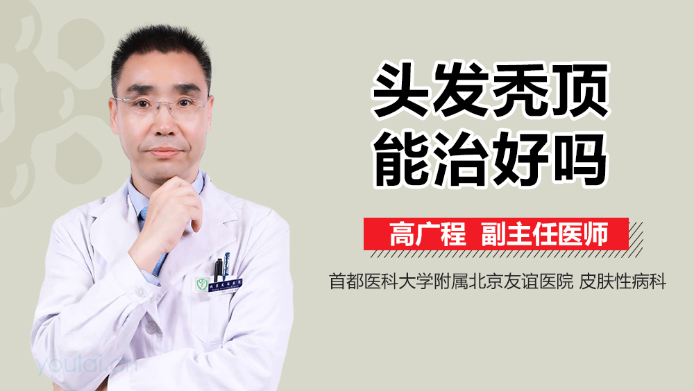头发秃顶能治好吗