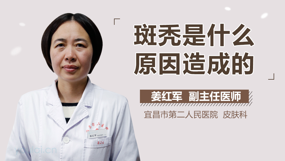 斑秃是什么原因造成的
