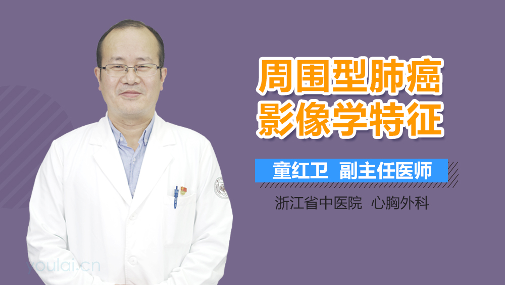 周围型肺癌影像学特征