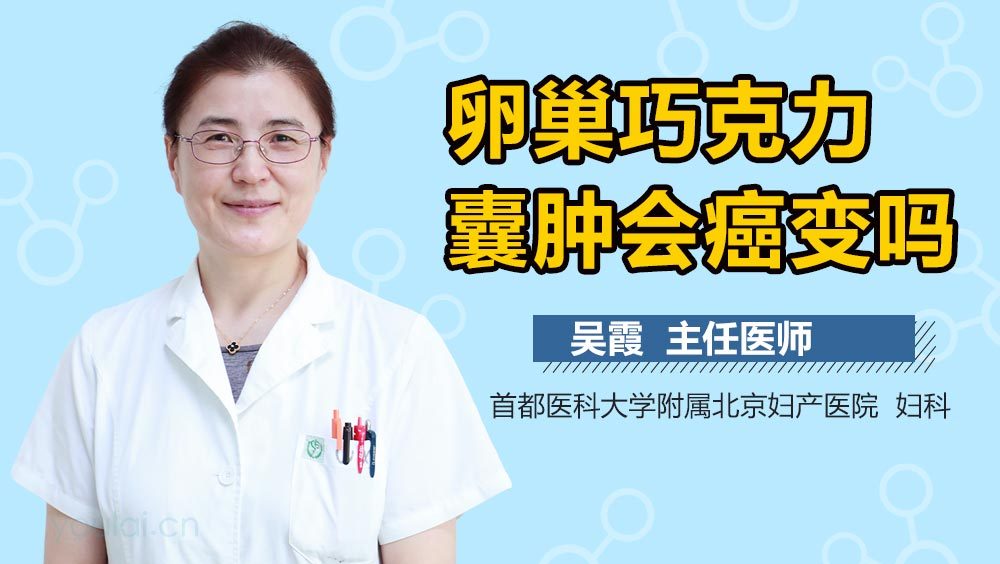卵巢巧克力囊肿会癌变吗
