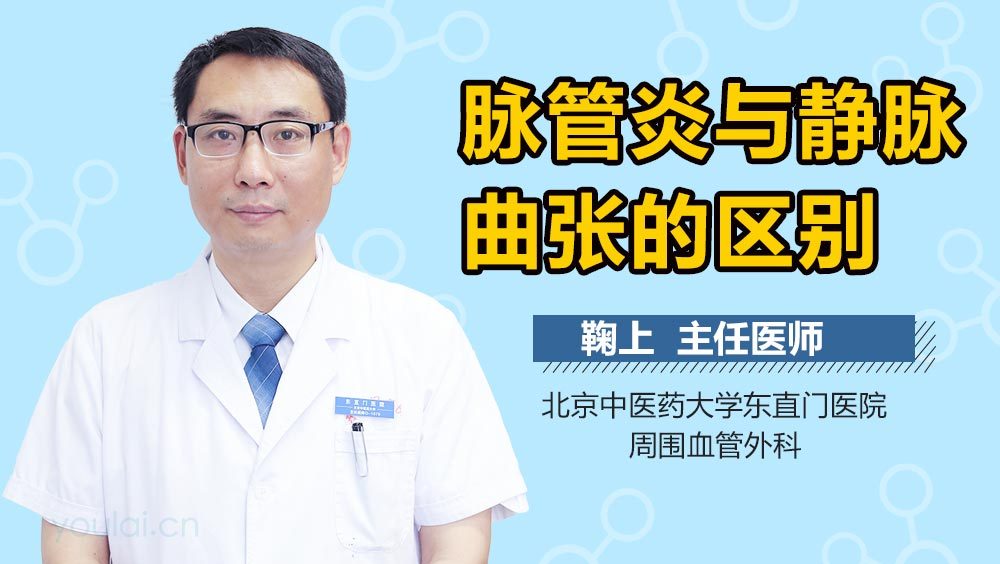 脉管炎与静脉曲张的区别