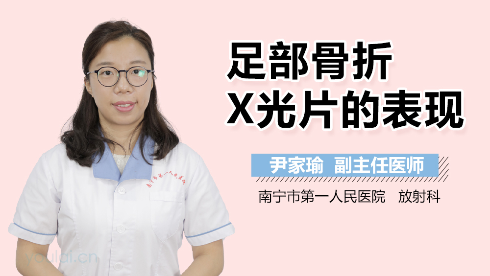 足部骨折X光片的表现