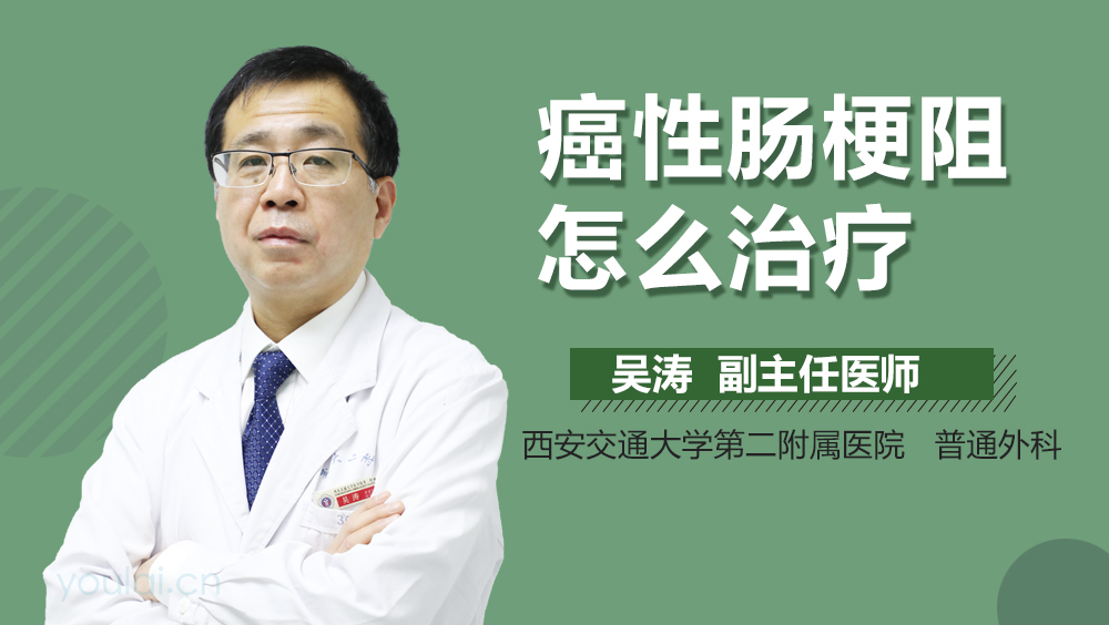癌性肠梗阻怎么治疗