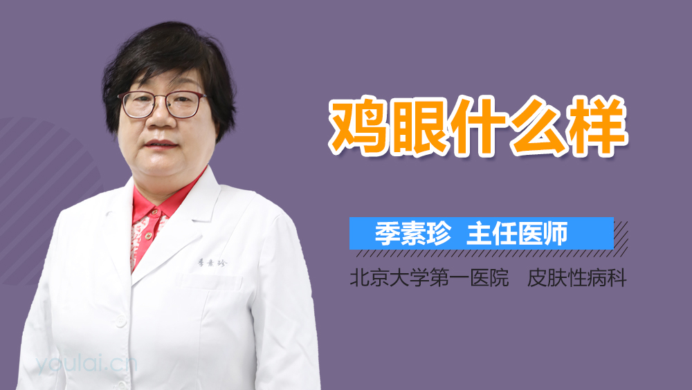 鸡眼什么样