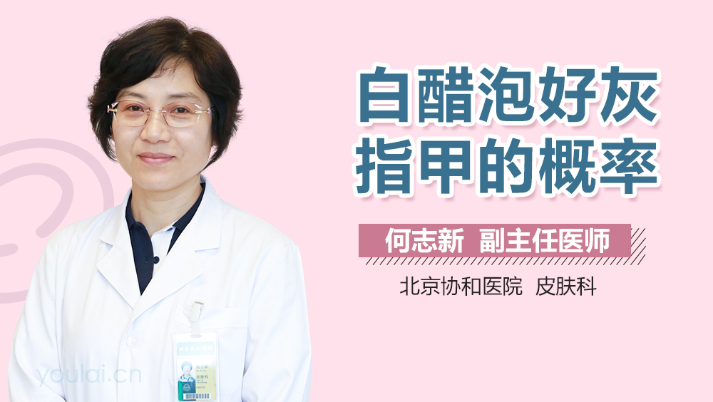 白醋泡好灰指甲的概率
