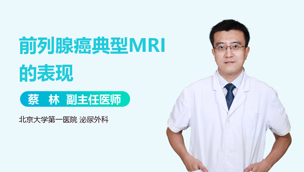 前列腺癌典型MRI的表现