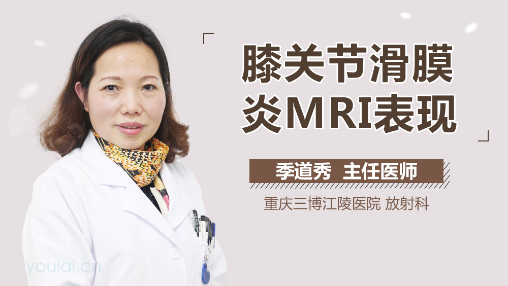 膝关节滑膜炎MRI表现