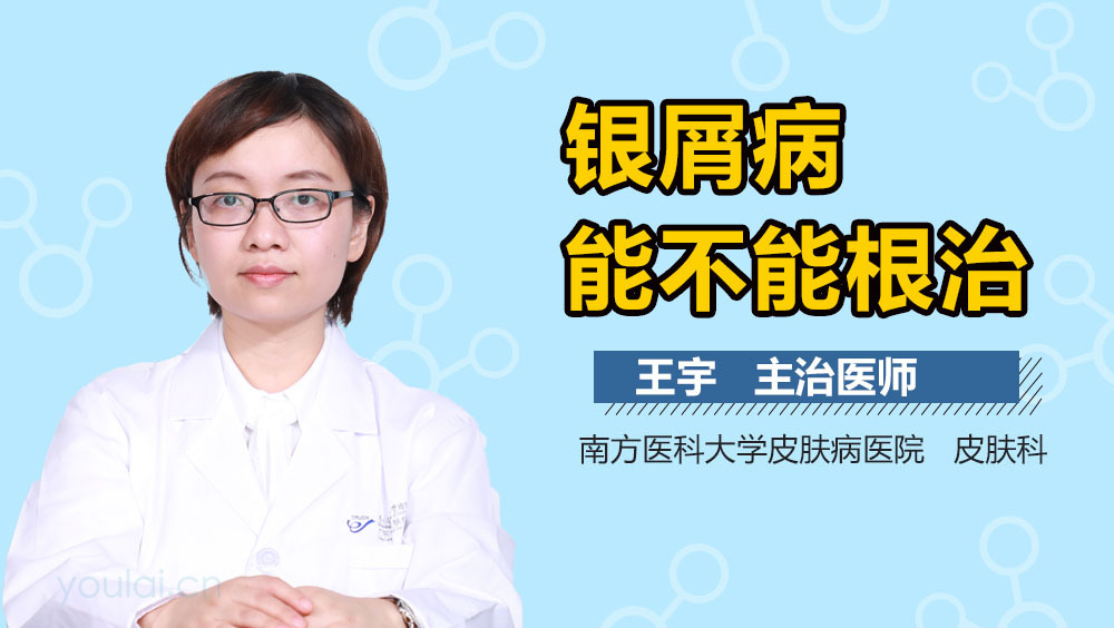 银屑病能不能根治