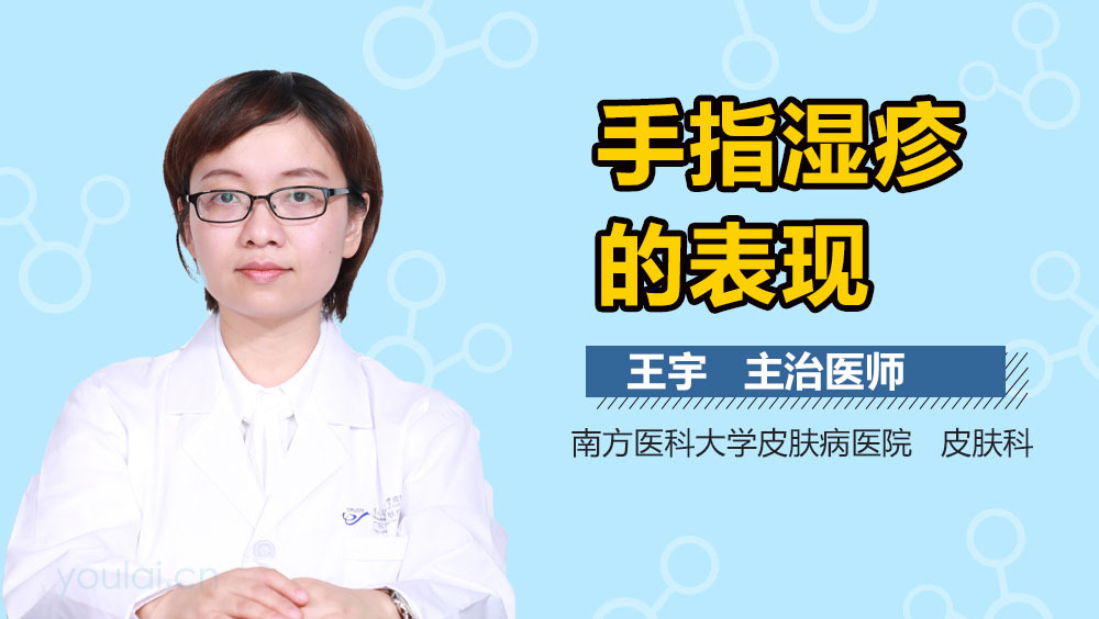 手指湿疹的表现