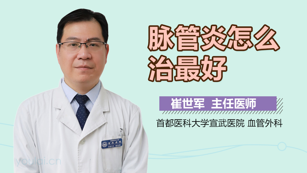 脉管炎怎么治最好