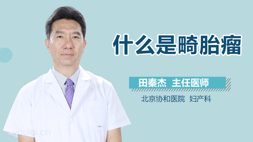 什么是畸胎瘤