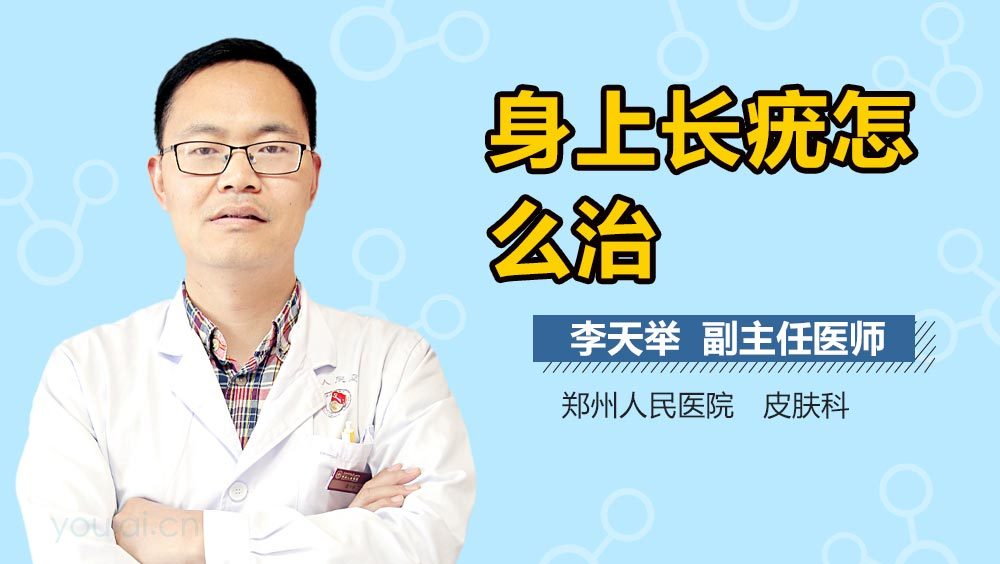 身上长疣怎么治