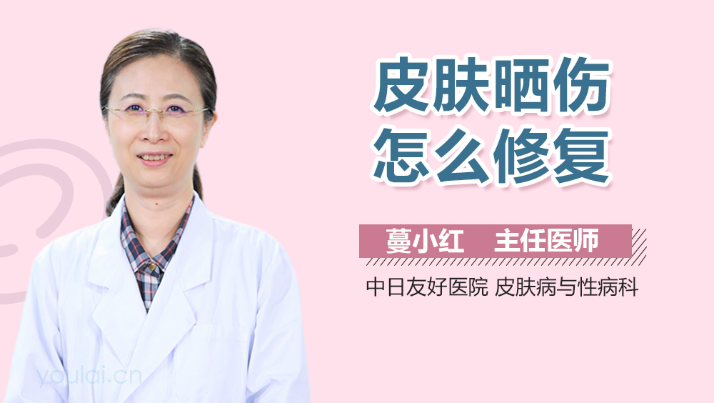 皮肤晒伤怎么修复