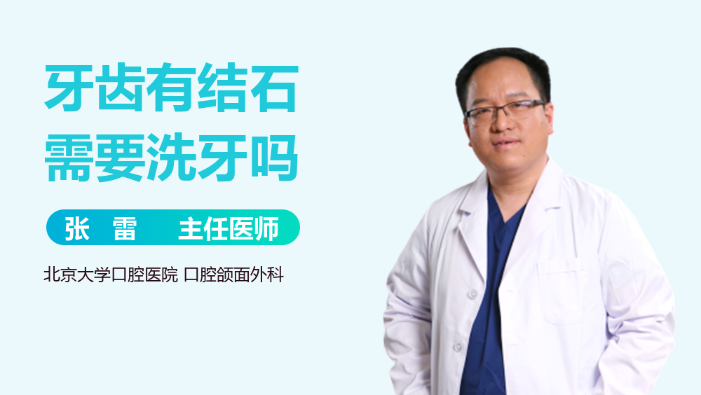 牙齿有结石需要洗牙吗