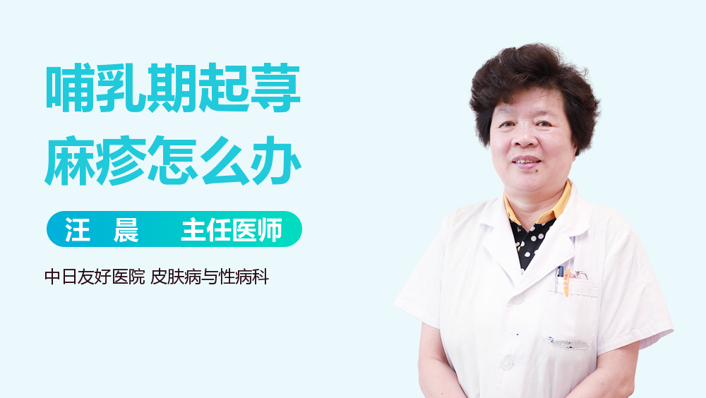 哺乳期起荨麻疹怎么办