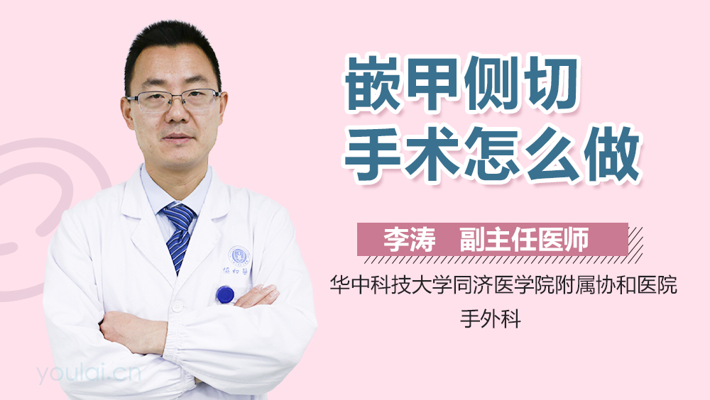 嵌甲侧切手术怎么做