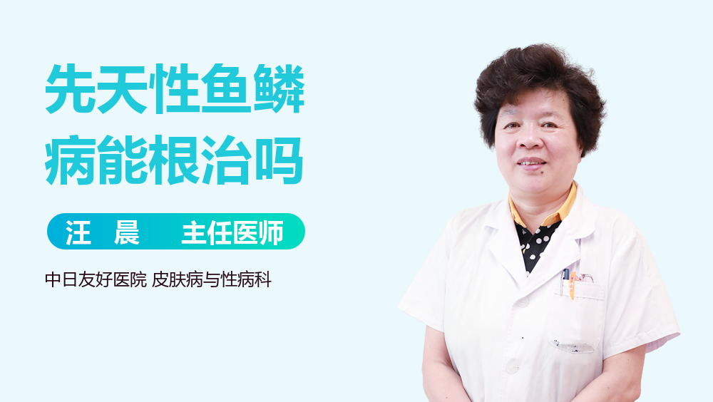 先天性鱼鳞病能根治吗
